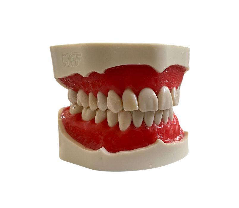 E02/N - 28-tooth model with screw-fixed gums and teeth